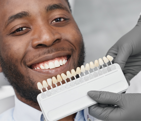 dental-shade-matching-smiling-man