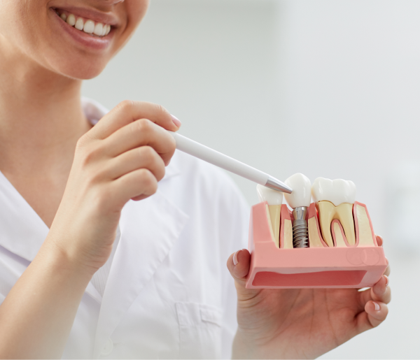 dental-doctor-implant-model-explanation