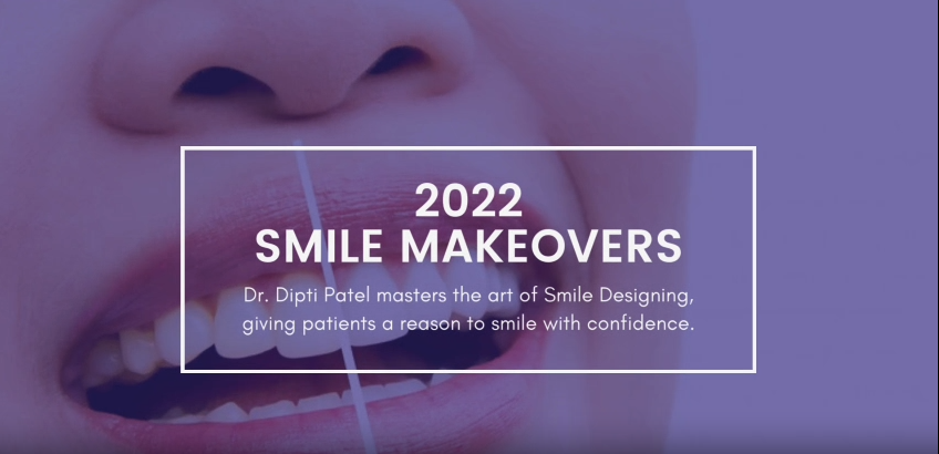 2022-smile-makeovers-dr-dipti-patel