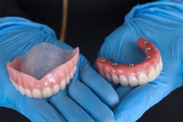 full-denture-versus-implant-supported-bridge-comparison