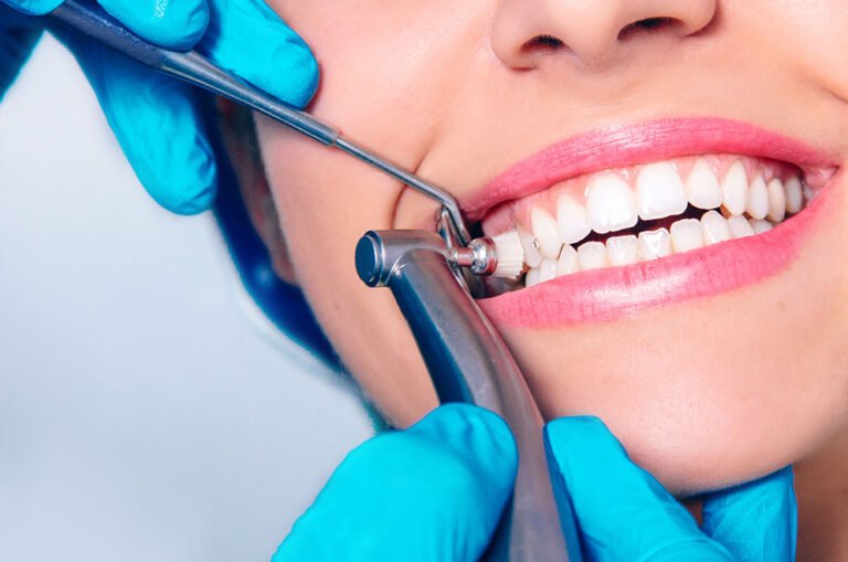 dental-prophylaxis-polishing-clean-teeth
