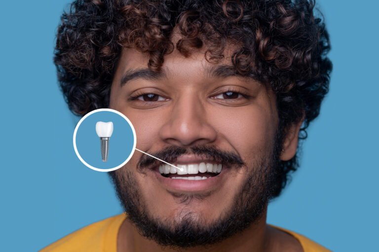smiling-man-with-dental-implant-diagram