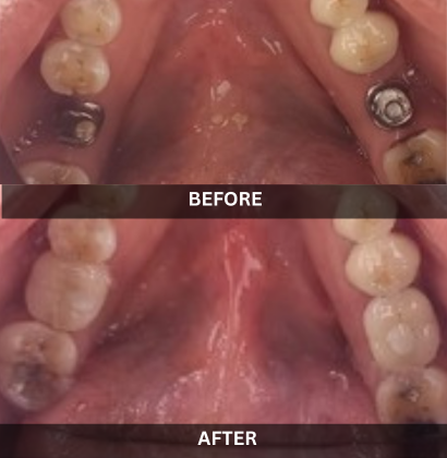 Akash_Dental_Care (1) (1)