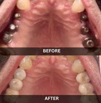 Akash_Dental_Care (1)