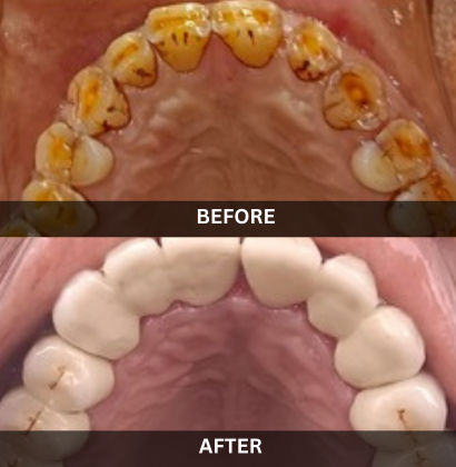 Akash_Dental_Care (3)