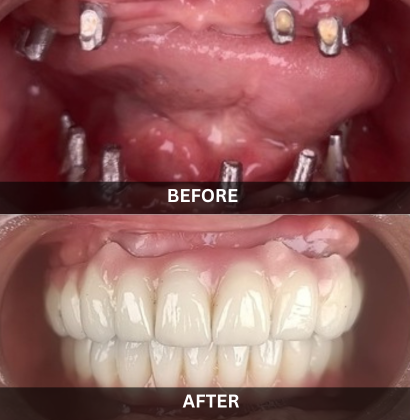 Akash_Dental_Care (4)