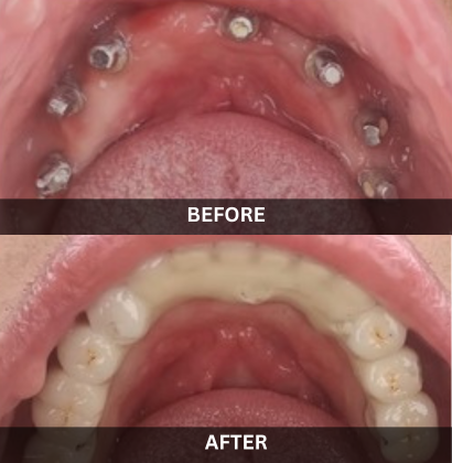 Akash_Dental_Care